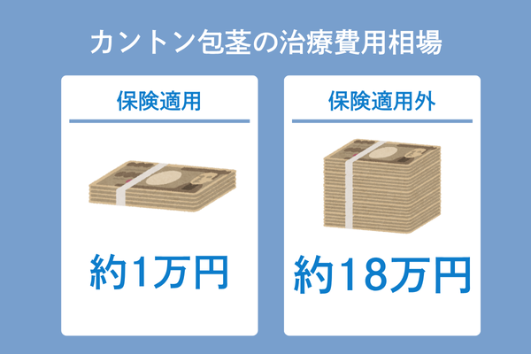 【アンケート】カントン包茎（嵌頓包茎）の治療費用・手術費用の相場を独自調査
