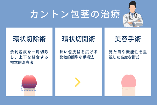 ”カントン包茎（嵌頓包茎）の治し方や治療法について"