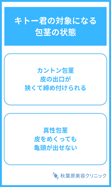 大見出し直下画像 キトー君の対象になる包茎の状態