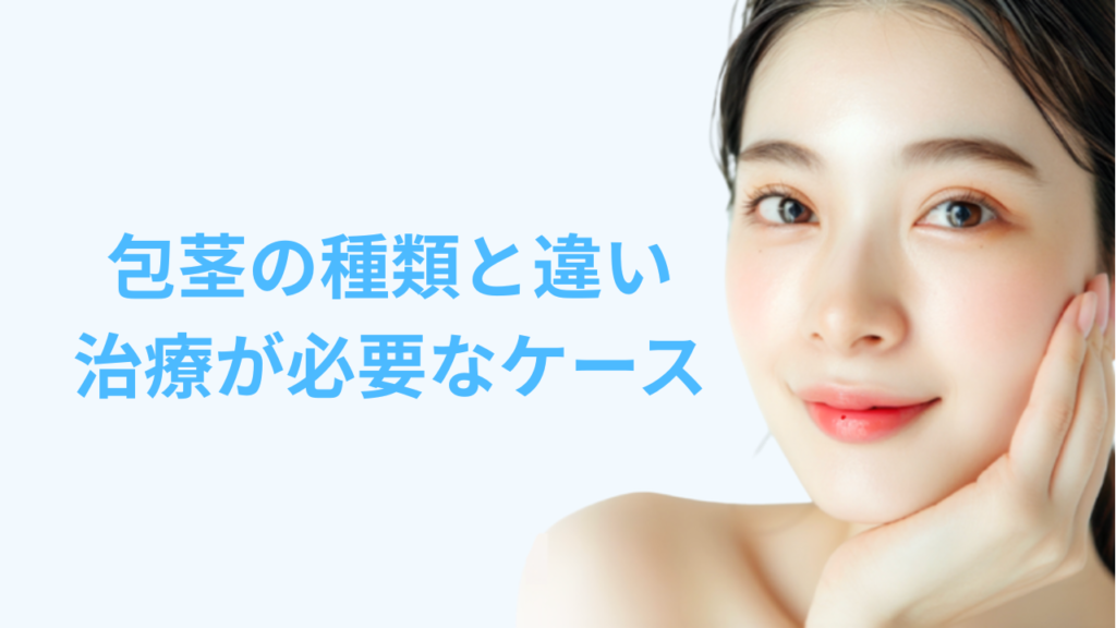 アイキャッチ画像 包茎の種類と違い、治療が必要なケース